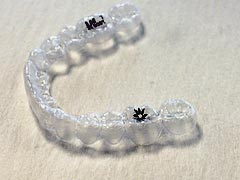 インビザライン